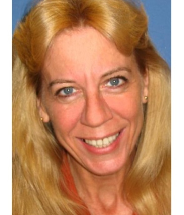 Sue Hunt